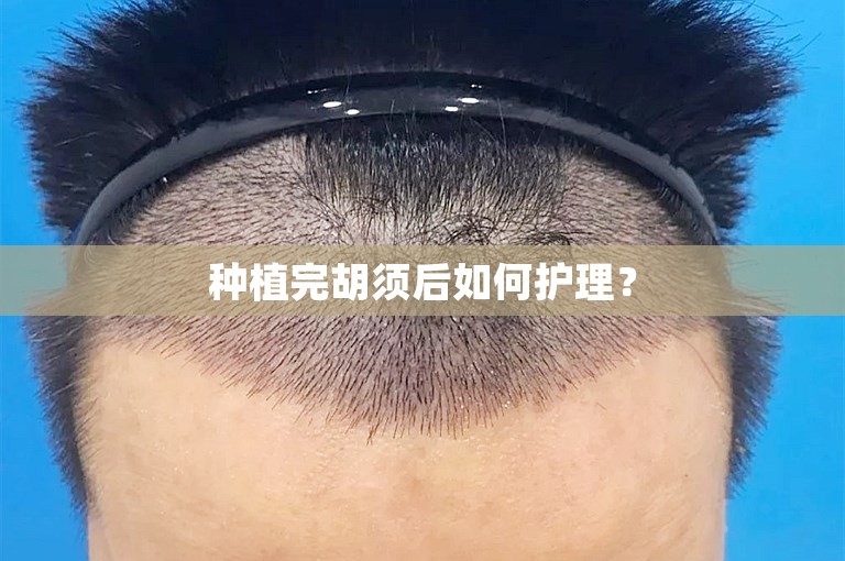 种植完胡须后如何护理？