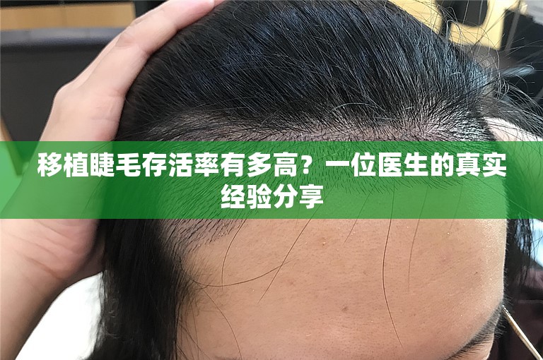 移植睫毛存活率有多高？一位医生的真实经验分享