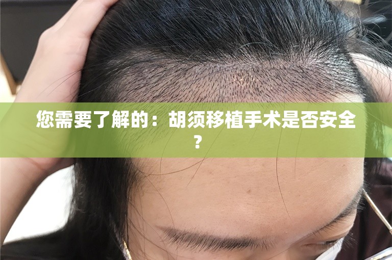 您需要了解的：胡须移植手术是否安全？