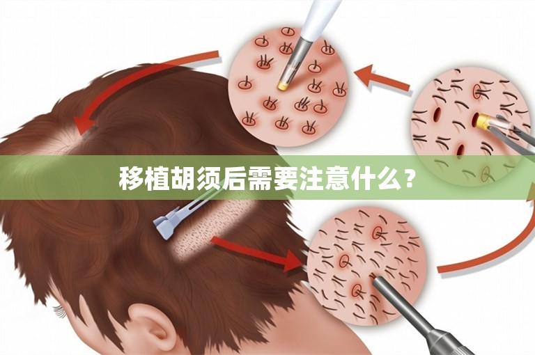 移植胡须后需要注意什么？