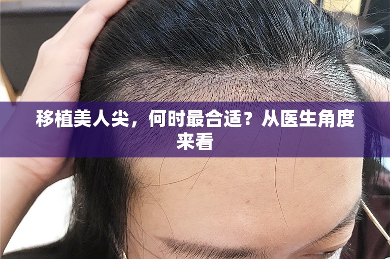 移植美人尖，何时最合适？从医生角度来看