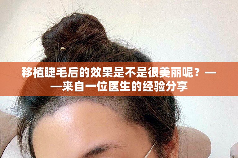 移植睫毛后的效果是不是很美丽呢？——来自一位医生的经验分享