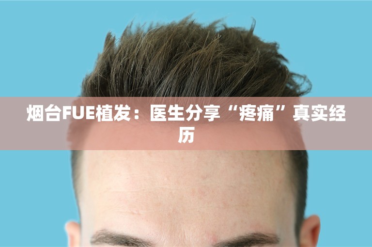 烟台FUE植发：医生分享“疼痛”真实经历