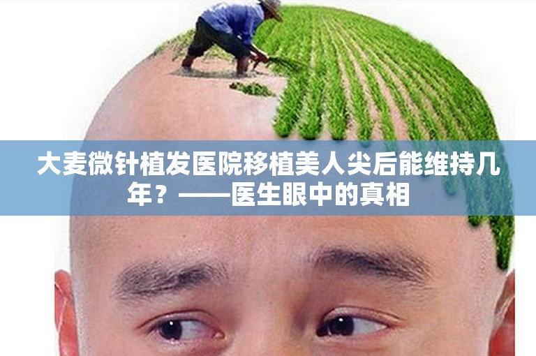 大麦微针植发医院移植美人尖后能维持几年？——医生眼中的真相