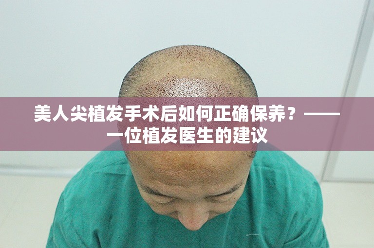 美人尖植发手术后如何正确保养？——一位植发医生的建议