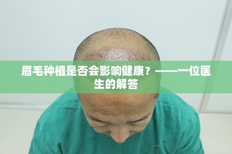 眉毛种植是否会影响健康？——一位医生的解答