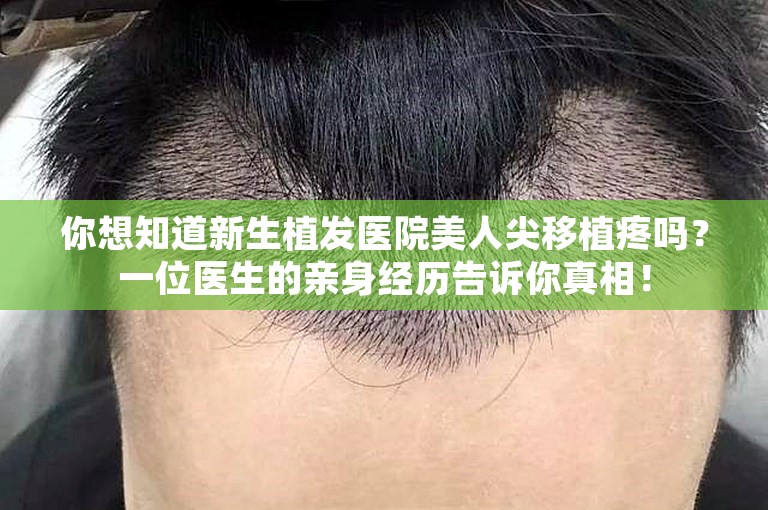 你想知道新生植发医院美人尖移植疼吗？一位医生的亲身经历告诉你真相！