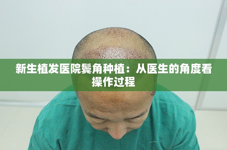 新生植发医院鬓角种植：从医生的角度看操作过程