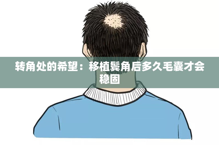 转角处的希望：移植鬓角后多久毛囊才会稳固