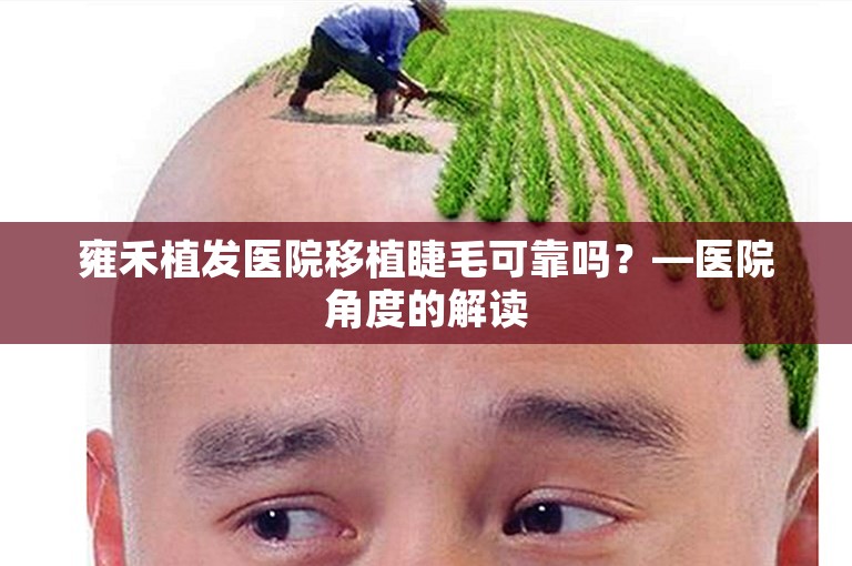 雍禾植发医院移植睫毛可靠吗？—医院角度的解读