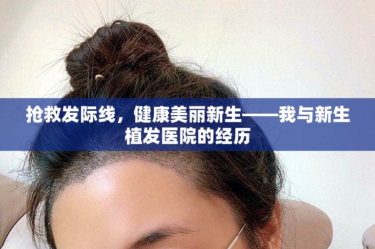 抢救发际线，健康美丽新生——我与新生植发医院的经历