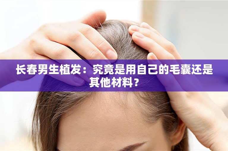 长春男生植发：究竟是用自己的毛囊还是其他材料？