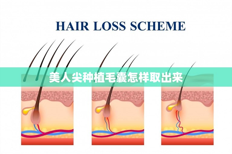 美人尖种植毛囊怎样取出来