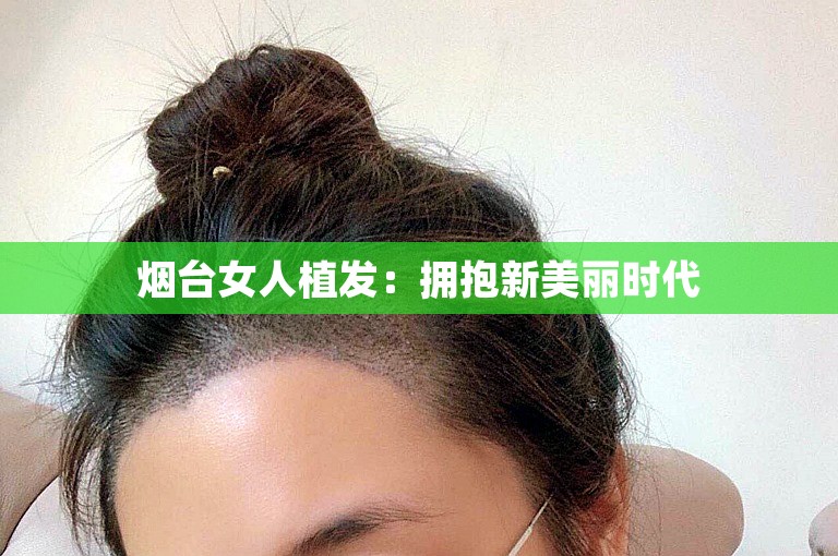 烟台女人植发：拥抱新美丽时代