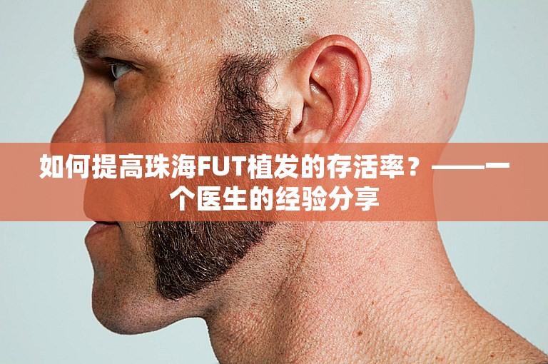 如何提高珠海FUT植发的存活率？——一个医生的经验分享