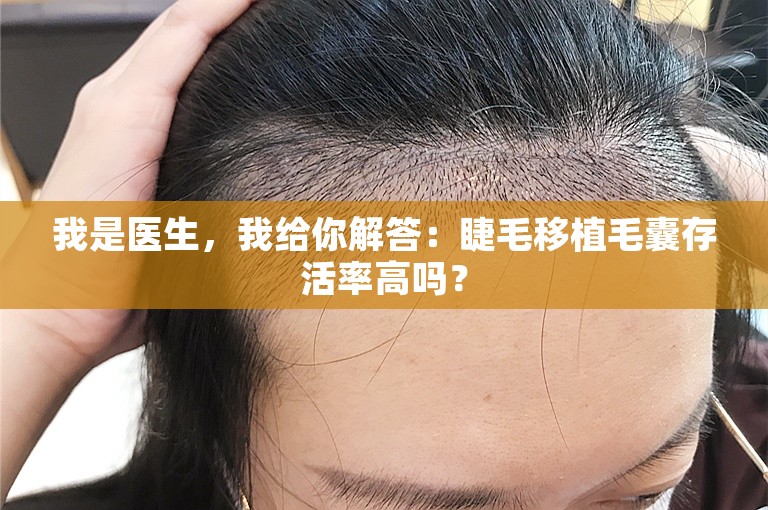 我是医生，我给你解答：睫毛移植毛囊存活率高吗？