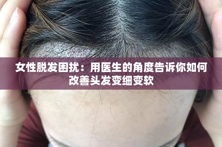 女性脱发困扰：用医生的角度告诉你如何改善头发变细变软