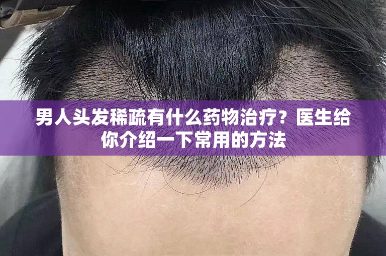 男人头发稀疏有什么药物治疗？医生给你介绍一下常用的方法