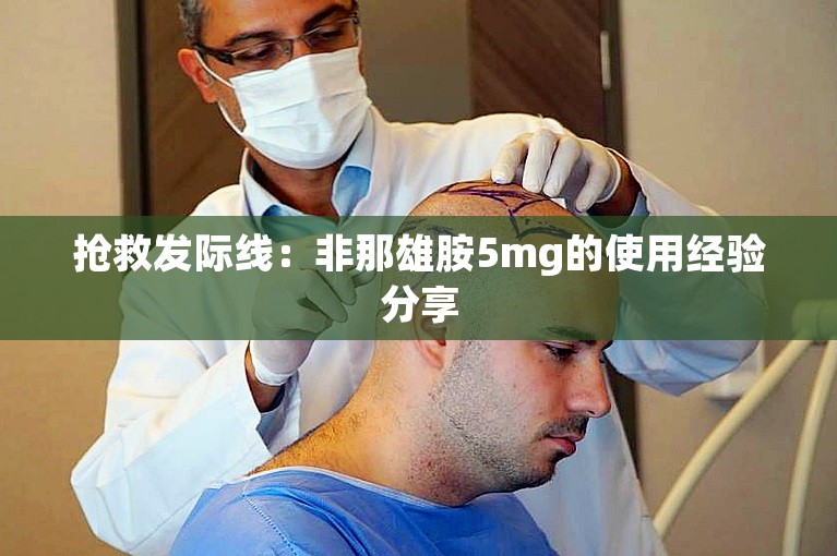 抢救发际线：非那雄胺5mg的使用经验分享