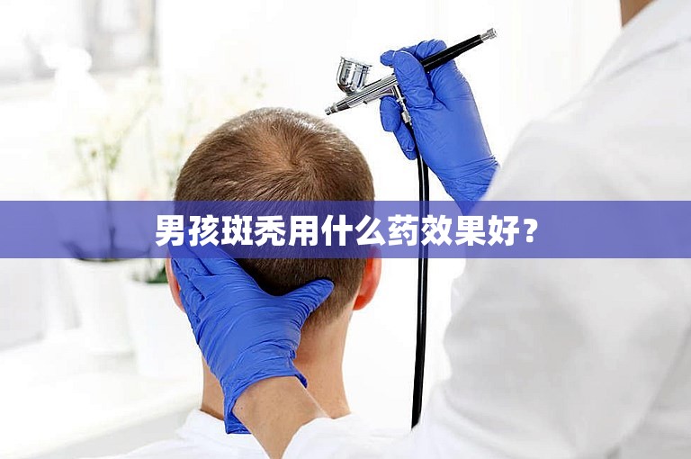 男孩斑秃用什么药效果好？