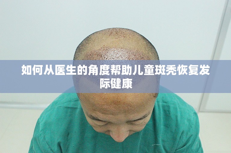 如何从医生的角度帮助儿童斑秃恢复发际健康