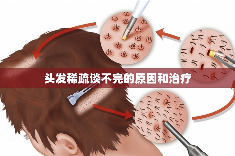 头发稀疏谈不完的原因和治疗