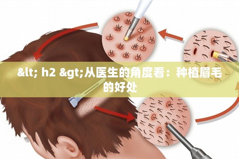 < h2 >从医生的角度看：种植眉毛的好处