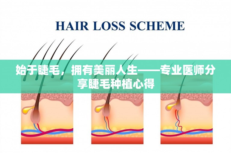 始于睫毛，拥有美丽人生——专业医师分享睫毛种植心得