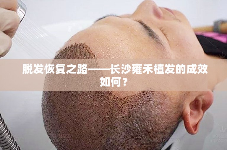  脱发恢复之路——长沙雍禾植发的成效如何？