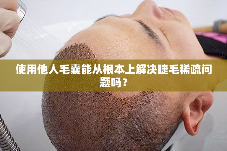 使用他人毛囊能从根本上解决睫毛稀疏问题吗？