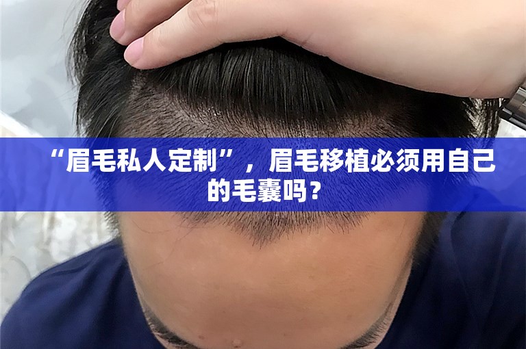 “眉毛私人定制”，眉毛移植必须用自己的毛囊吗？