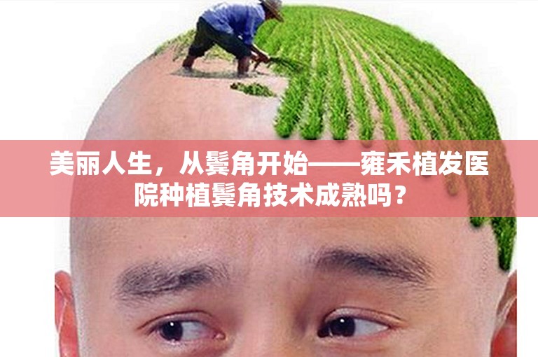 美丽人生，从鬓角开始——雍禾植发医院种植鬓角技术成熟吗？