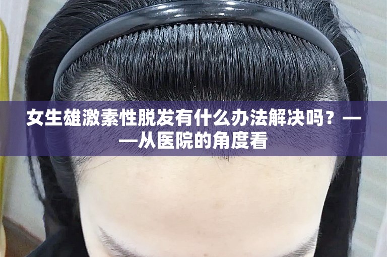 女生雄激素性脱发有什么办法解决吗？——从医院的角度看