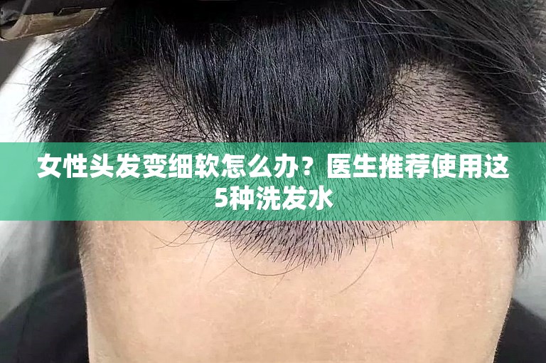 女性头发变细软怎么办？医生推荐使用这5种洗发水