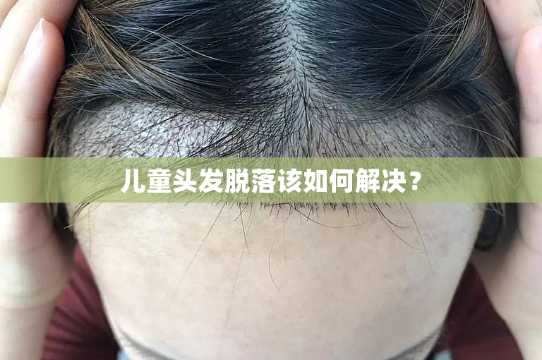 儿童头发脱落该如何解决？