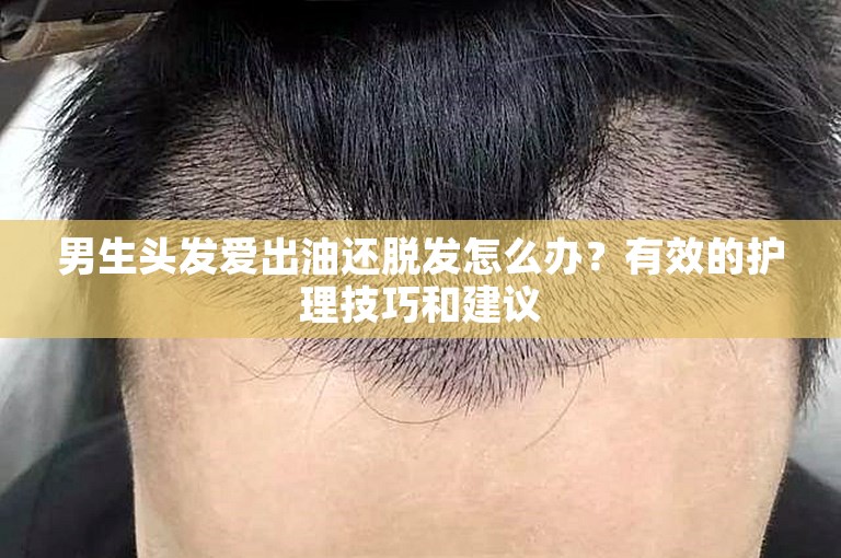 男生头发爱出油还脱发怎么办？有效的护理技巧和建议