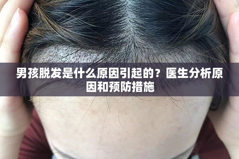 男孩脱发是什么原因引起的？医生分析原因和预防措施