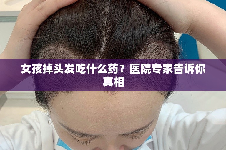 女孩掉头发吃什么药？医院专家告诉你真相