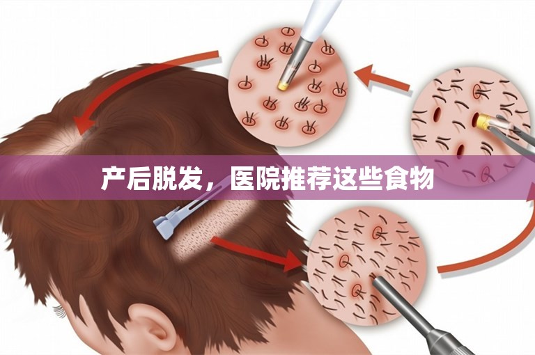 产后脱发，医院推荐这些食物