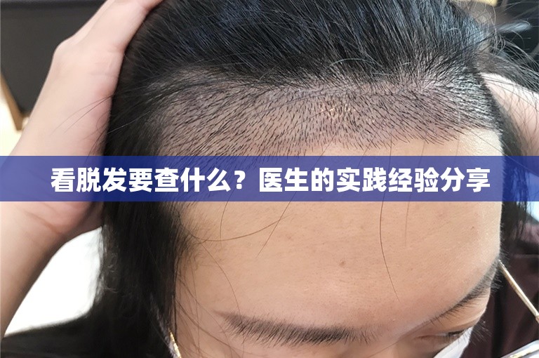 看脱发要查什么？医生的实践经验分享