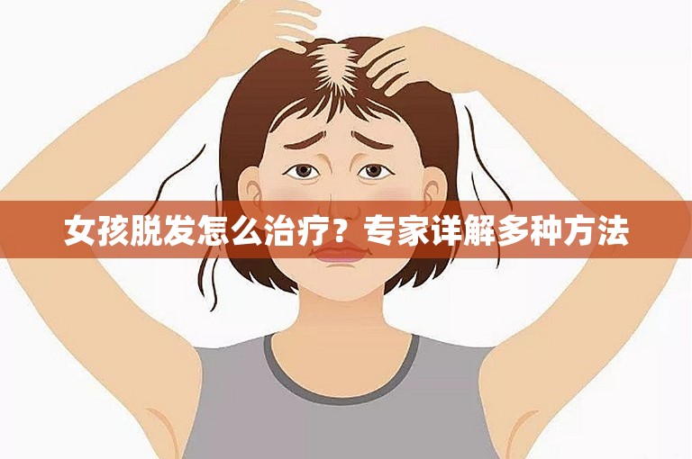 女孩脱发怎么治疗？专家详解多种方法