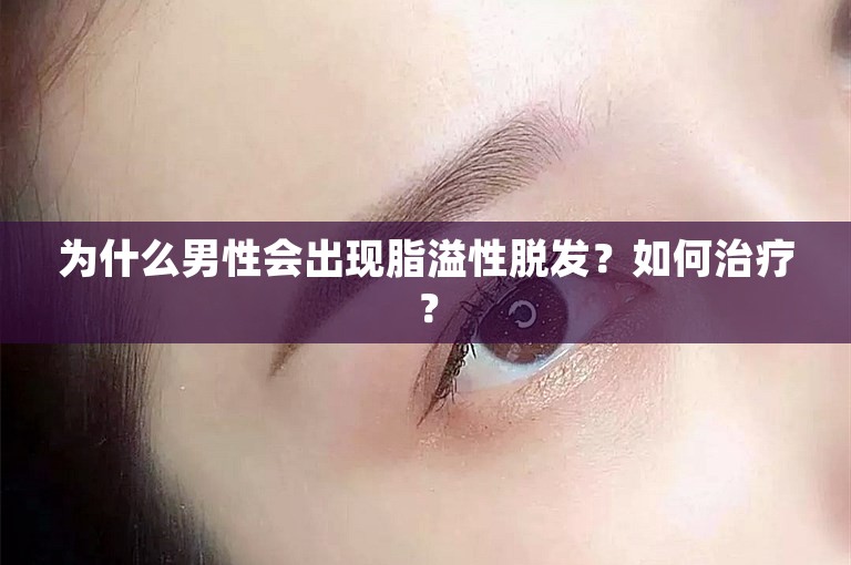 为什么男性会出现脂溢性脱发？如何治疗？