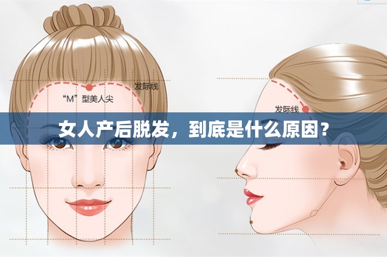 女人产后脱发，到底是什么原因？