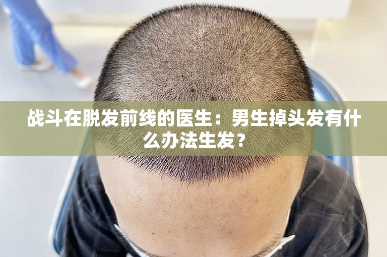 战斗在脱发前线的医生：男生掉头发有什么办法生发？