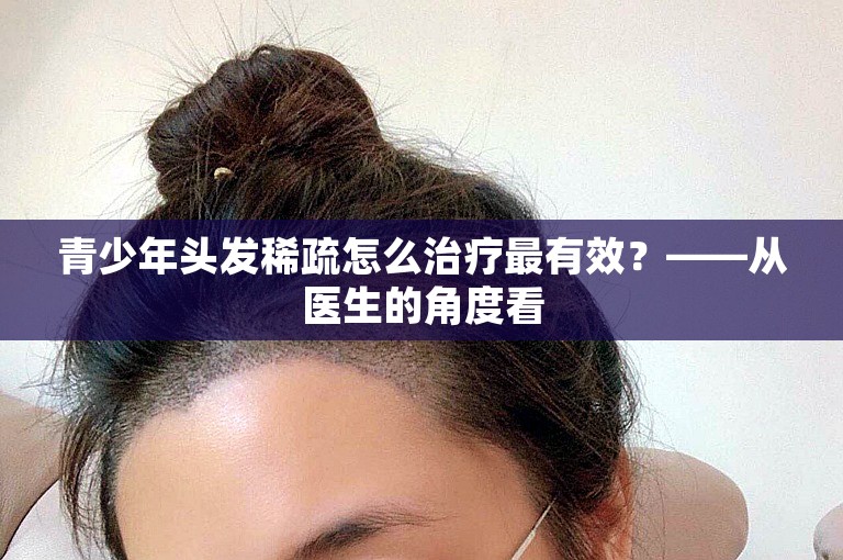 青少年头发稀疏怎么治疗最有效？——从医生的角度看