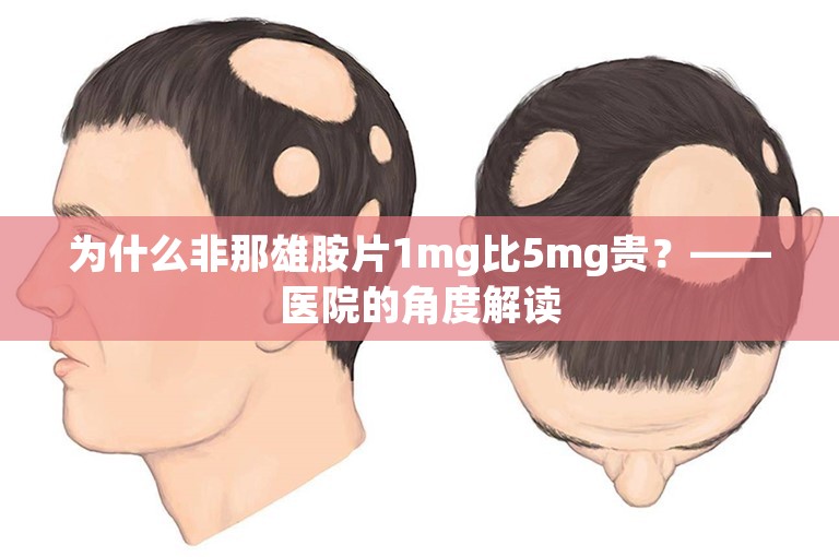 为什么非那雄胺片1mg比5mg贵？——医院的角度解读