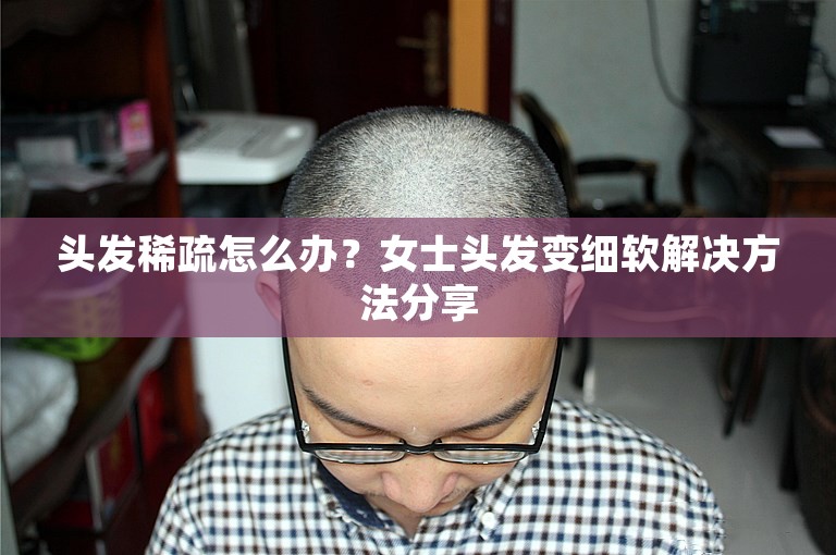 头发稀疏怎么办？女士头发变细软解决方法分享