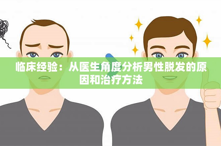 临床经验：从医生角度分析男性脱发的原因和治疗方法