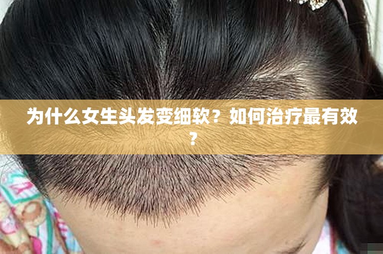 为什么女生头发变细软？如何治疗最有效？