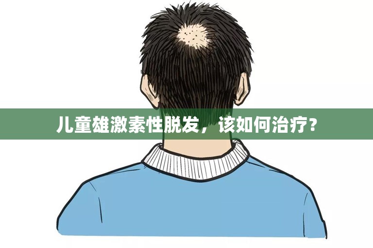 儿童雄激素性脱发，该如何治疗？